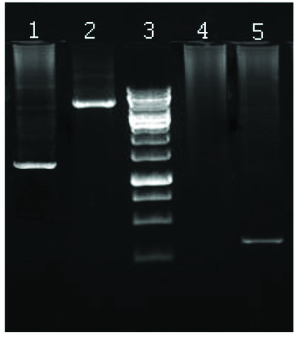 Lane 1: PCR product using M1 forward and M13 reverse primers on recombinant bacmid; amplification of a region with 1400 bp in length as expected. Lane 2: PCR product using forward and reverse M13 primers on recombinant bacmid (7200bp). Lane 3: 1Kb DNA marker (Fermentas). Lane 4: PCR product using M1 forward and M13 reverse primers on nonrecombinant bacmid as a negative control. No band was observed as expected. Lane 5: PCR product using M13 primers (303bp) on nonrecombinant bacmid as a negative control.