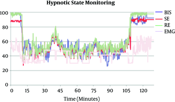 Bispectral Index (BIS), State Entropy (SE) and Response Entropy (RE) Monitoring of Patient No. 1