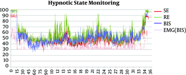 Bispectral Index (BIS), State Entropy (SE) and Response Entropy (RE) Monitoring of Patient No 2