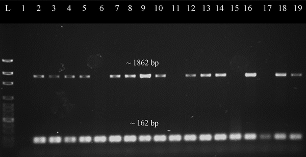 Representative gel image of duplex PCR screening for tetM gene. Lane L was loaded with 100 bp ladder (New England Biolabs, UK), lane 1 was loaded with negative control, lane 2 was loaded with positive control, while lane 3 to 19 were loaded with PCR products which amplified from different DNA samples of the MRSA isolates. The mecA gene (~162 bp) was present in every sample. Most of samples have target gene tetM (~1862 bp) present except for the samples in lanes 6, 11, 15 and 17.