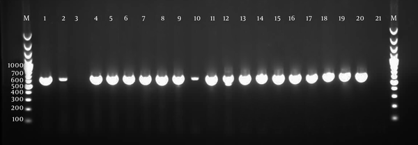 Lane M, 100 bp DNA ladder; Lane 1, positive control, DNA of Blastocystis (600 bp); Lane 2,4- - 20, positive samples; Lane 3, negative sample, Lane 21, negative control.