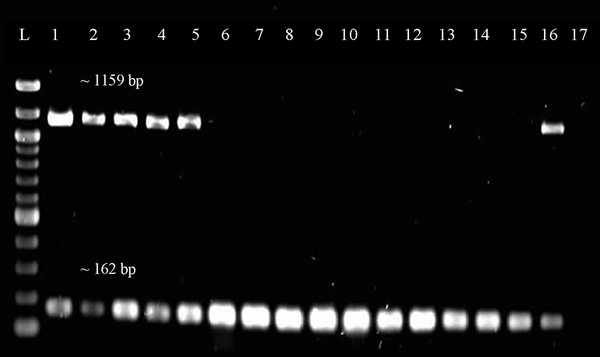 Representative gel image of duplex PCR screening for tetK gene. Lane L was loaded with 100 bp ladder (New England Biolabs, UK) while Lane 1 to 17 were loaded with PCR products from different DNA samples of the MRSA isolates. Lane 16 is a positive control while Lane 17 is a negative control. The size of the band is 1159 bp for tetK gene and approximately 162 bp for mecA gene.