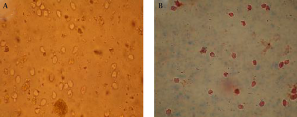 A, Before exposure to the ozonized olive oil (100% live cysts); B, after exposure to the ozonized olive oil (100% dead cysts).