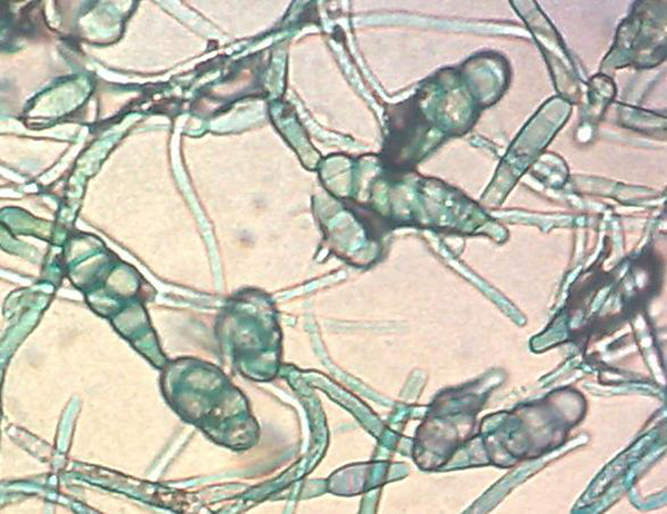 Alternaria spp. Macroconidia Isolated From Patients