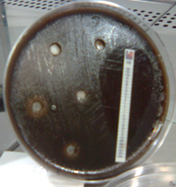 Antibiogram of Helicobacter pylori  Isolates by the E-Test Method