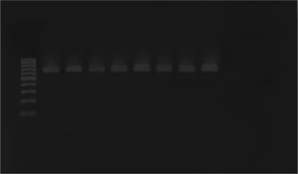 M, DNA molecular size marker (100-bp ladder); lanes 1-8, E. coli clinical isolates containing the ipaH gene (619 bp); lane 9, negative control (without DNA template).