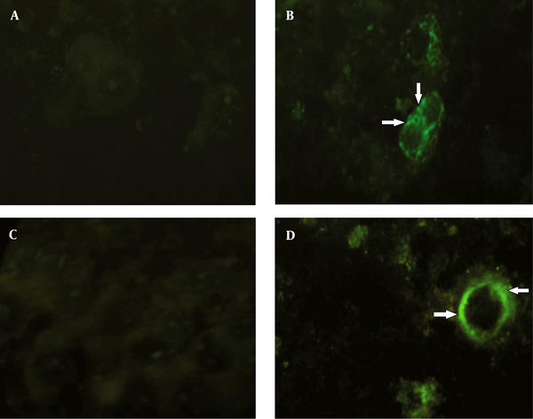 A: no immunofluorescence was detected in mock-infected Huh7 cells using conjugated antibodies to the HA tag. B: HA expression and its specific localization (arrows) at the cell surface membrane of the Huh7 cells. C: no immunofluorescence was detected in mock-infected Huh7 cells using conjugated antibodies to the myc tag. D: myc expression and its specific localization (arrows) at the cell surface membrane of the Huh7 cells.