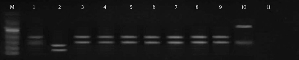 M, molecular marker (50 bp); lane 1, standard L. major; lane 2, L. tropica; lanes 3 - 9, PCR products; lane 10, the only sample different from the normal samples and standard patterns, probably flagellates; lane 11, negative control.