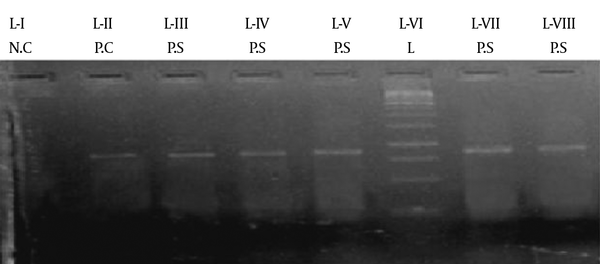 L-I shows the negative control without template DNA. L-II is the positive control of the G27 strain. L-III, L-IV, L-V, and L-VII show positive samples, while L-VI is a 1 kb ladder. NC, negative control; PC, positive control; PS, positive sample; L, 1 kb ladder.