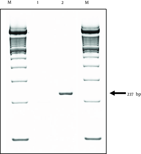 Lane 1, BFF_NCC1 cells; lane 2, PBMCs; M, marker (100-bp DNA ladder).