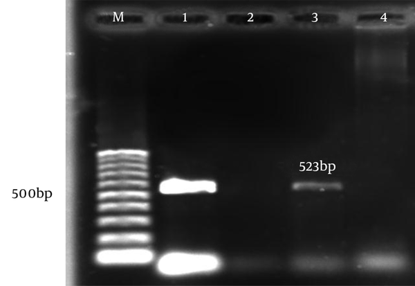 M, 100 bp marker; 1, positive control; 2, negative control; 3, positive sample; 4, negative sample for aph(3)-llla PCR.