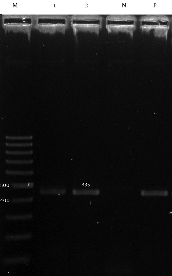 Lane M, 100 bp DNA size marker; Lane P, A. baumannii ATCC19606 positive control; Lane N, negative control; Lane 1 and 2, adeC gene positive isolate.