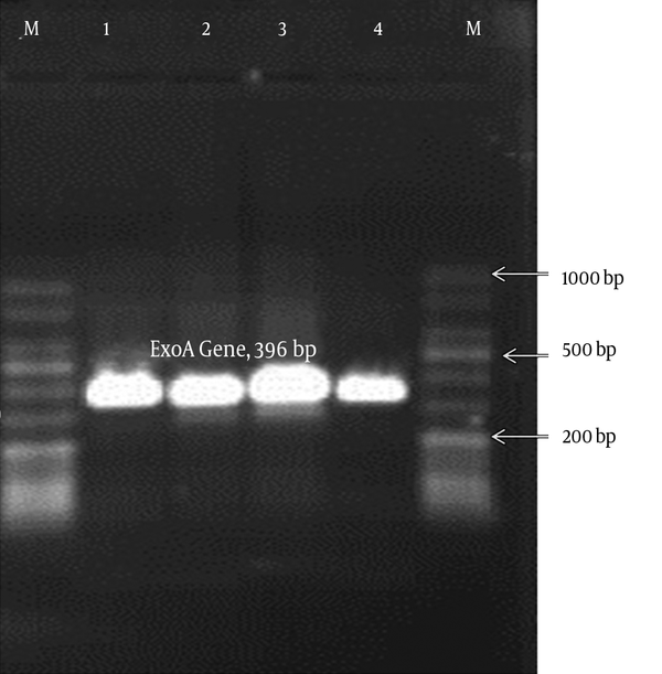Lane M, 50-bp DNA ladder; Lanes 1 to 3, P. aeruginosa; and Lane 4, P. aeruginosa ATCC 27853 (positive control).
