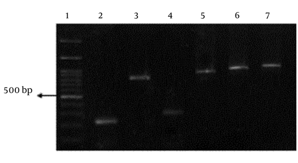 No 1, DNA marker (100 kb). No 2, blaSHV (231 bp), No 3, blaTEM (858 bp), No 4, blaOXA-10 (276), No 5, positive control for blaGES (864 bp), No 6, positive control for blaKPC (893 bp), No 7, blaPER (925 bp).