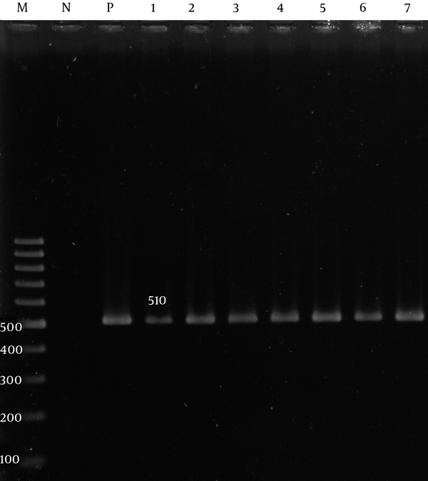 Lane M, 100 bp DNA size marker; Lane P, A. baumannii ATCC19606 positive control; Lane N, negative control; Lane 1 - 7, adeA gene positive isolate.