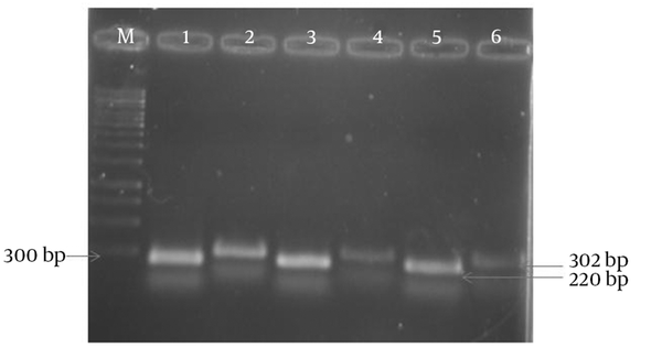 “M”: 1 kb marker; “1, 3 and 5”: C. albicansAPR1 gene (1- control and 3, 5- MS patients); “2, 4 and 6”: C. albicans 18S rRNA gene (2- control and 4, 6- MS patients).