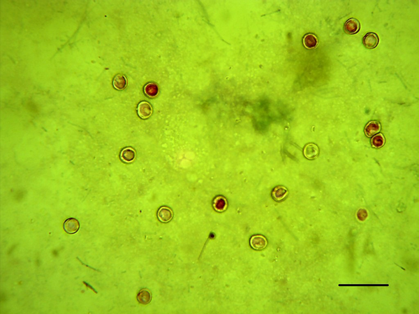 Ziehl-Neelsen Staining, Cryptosporidium parvum Oocysts in the Intestine Material of the Infected Neonatal Wistar Rats (Scale Bars 20 µ)