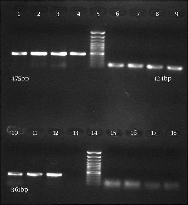C. albicans (lane 1 - 4), DNA ladder plus 100 bp (lane 5), C. parapsilosis (lane 6 - 9), C. glabrata (lane 10 - 12), H2O as negative control (lane 13), DNA ladder plus 100 bp (lane 14), Aspergillus (lane 15), S. cerevisiae (lane 16), C. tropicalis (lane 17), C. krusei (lane 18).
