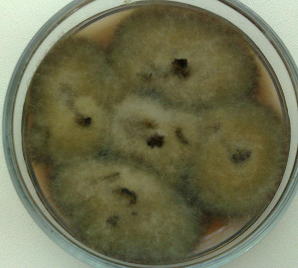 Appearance of Alternaria spp. Colonies Growth in Microbiological Examination