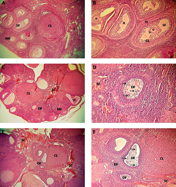 A and B, In the sham group, some types of follicles, corpus luteum, and atretic foliclles are observed. C and D, In the SCI group (14th day after SCI), types of  follicles are observed and atretic foliclles increased, also heterogeneous and stromal congestion including inflamatory cells are abvious. E and F, In the SCI group (21th day after SCI), types of degenerative follicles and stromal congestion are observed, also increase of inflammatory cells and heterogeneous stroma are observed. SC, Stromal Congestion; DF, Degenerative Follicles; CL, Corpus Luteum; O, Oocyte; MF, Multilaminar Primary Follicles; SF, Secondary Follicles. Apoptotic cells (arrows), zona pellocida (arrowhead), H and E staining, magnification 40× and 100×.