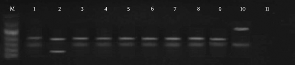 M, molecular marker (50 bp); lane 1, standard L. major; lane 2, standard L. tropica; lanes 3 - 9, PCR products; lane 10, the only sample different from the normal samples and standard patterns, probably flagellates; lane 11, negative control.