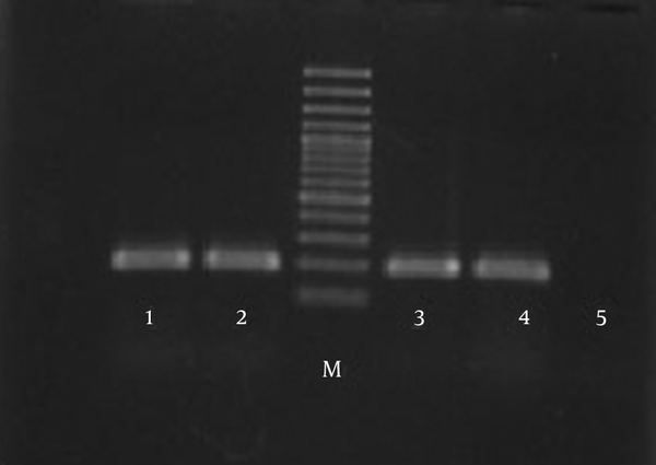 Lanes 1, 2, 3, and 4, 185 bp fragments; M, molecular weight marker; 5, negative control.