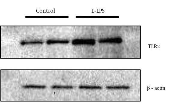 Cells were stimulated by 1 μg/mL of L-LPS for 6 hours. Unstimulated cells were used as a control. The two lanes shown for the respective experimental conditions are the results obtained from duplicate experiments in which the cells were separately prepared. Anti-β-actin polyclonal antibody was used to detect β-actin as a loading control.