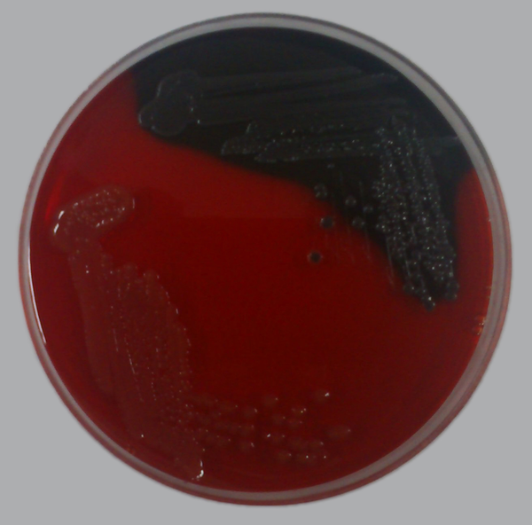 Biofilm Producing Strain (Black Colonies) and Non-Biofilm-Producing Strain (Red Colonies) of E. coli Grown on Congo-red Medium
