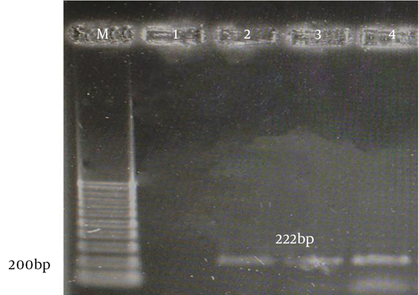 M, 100 bp marker; 1, negative control; 2, positive control; 3 and 4, positive samples for aac(6)-le-aph(2)la PCR.