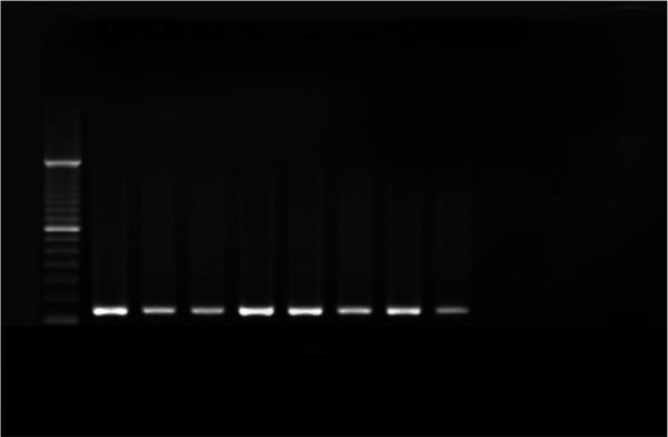 M, DNA molecular size marker (100-bp ladder); lanes 1-8, E. coli clinical isolates containing the fimH gene (150 bp); lane 9, negative control (without DNA template)