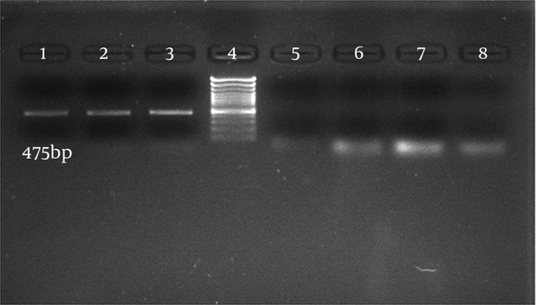 Clinical C. albicans (lane 1 - 3), DNA ladder plus 100 bp (lane 4), Cryptococcus (lane 5), S. cerevisiae (lane 6), C. tropicalis (lane 7), C. krusei (lane 8).