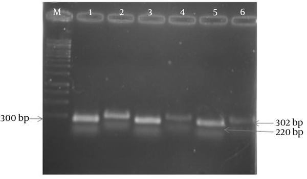 “M”: 1 kb marker; “1, 3 and 5”: C. albicans APR1 gene (1-RR, 3-PR and 5-SP); “2, 4 and 6”: C. albicans 18S rRNA gene (2-RR, 4-PR and 6-SP).