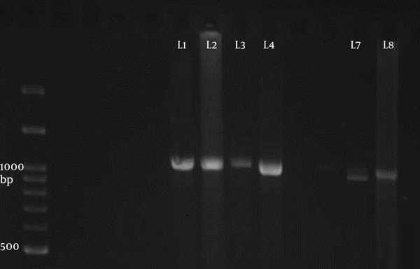 The Electrophoresis of the PCR Product of 18S Ribosomal Gene of Sarcocystis in Sheep Samples Presented 2 Bands 1100 (Line 1 - 4) and 900 bp (Line 7 - 8) belonged to S. tenella and S. capracanis, Respectively.