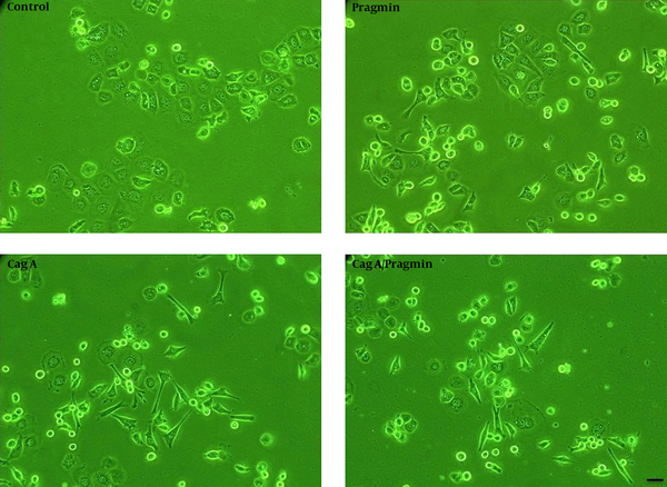 AGS cells were transfected with different vectors (Scale bars, 10 μm).