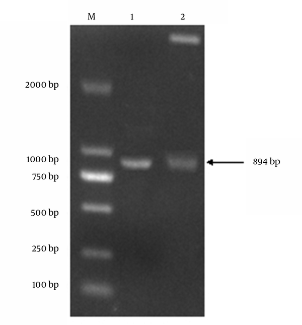 M: DL2000 DNA marker; 1: phosphoprotein gene fragment; 2: digestion production of pET-32a-P by EcoR I and Sal I Enzymes.