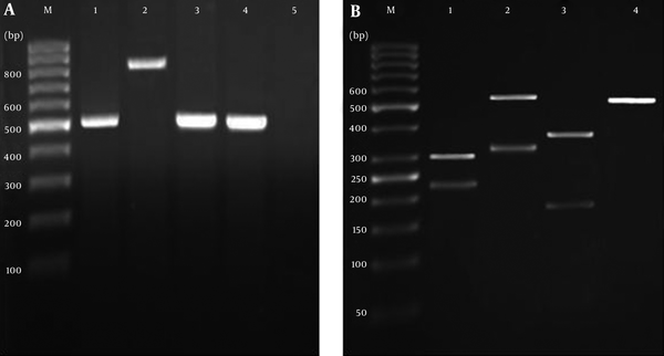 A) PCR products before the digestion step, B) profiles of ITS-RFLP products after digestion using MSPI enzyme (lane 1, C. albicans; lane 2, C. glabrata; lane 3, C. tropicalis; lane 4, C. parapsilosis; lane 5, negative control; lane M, DNA size marker)