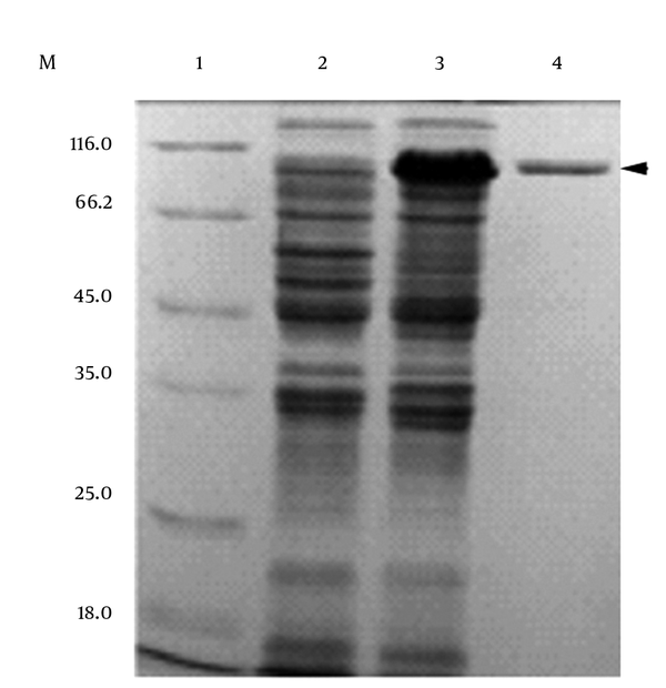 M: Protein marker; 1: supernatant sample from induced pET-28a (+)/BL21(DE3); 2: supernatant sample from induced pel-ek-his-slo/BL21(DE3); 3: purified the fusion protein of pectate lyase and Streptolysin O by Ni2+-nitrilotriacetate-agarose column (loading buffer with 10 mmol/L imidazole binding; binding buffer: with 10 mmol/L imidazole; washing buffer: with 60 mmol/L imidazole; eluting buffer: with 100 - 500 mmol/L imidazole).