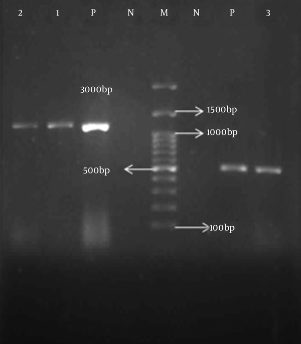 N; Negative Control, P; Positive Control, 1 and 2; Positive Isolates for hlyA gene, 3; Positive Isolates for cnf1 Gene, M; DNA Size Marker.
