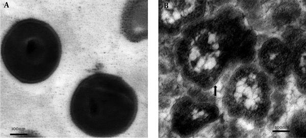 A, Normal S. aureus cells with spherical shape and thick cell wall; B, S. aureus L-forms displaying a variety of morphological types with completely or partially missing cell wall (black arrow).