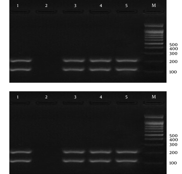 Electrophoresis of PCR Products Using Strain-Specific Oligonucleotide ssrRNA to Detect Mixed Infection (Plasmodium vivax and Plasmodium falciparum) in the Samples; a 100-bp Marker Was Used.