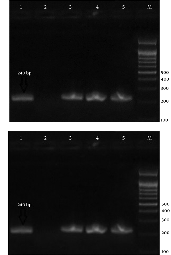 Electrophoresis of PCR Products Using Strain-Specific Oligonucleotide ssrRNA to Detect Malaria Parasites in the Samples; a 100-bp Marker Was Used.