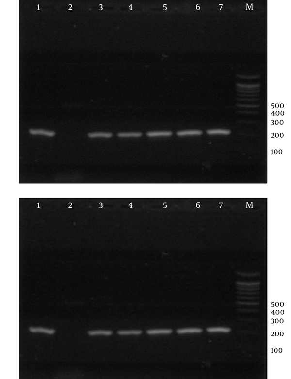 Electrophoresis of PCR Products Using Strain-Specific Oligonucleotide ssrRNA to Detect Plasmodium falciparum in the Samples; a 100-bp Marker Was Used.