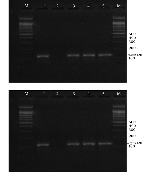 Electrophoresis of PCR Products Using Strain-Specific Oligonucleotide ssrRNA to Detect Plasmodium vivax in the samples; a 100-bp Marker Was Used.
