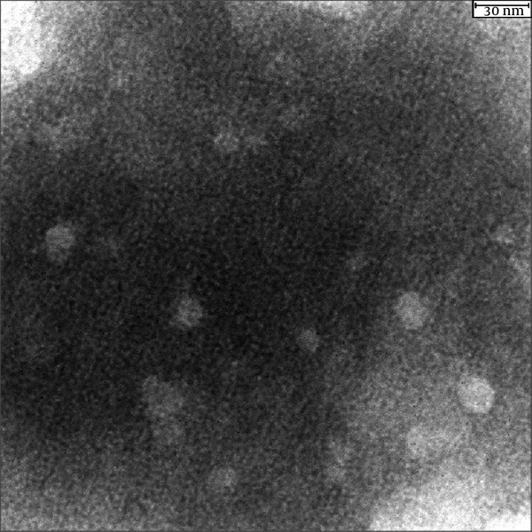 The Transmission Electron Microscopy of ORF2-NSP4. Uranyl acetate (2%) was used to stain the VLPs.