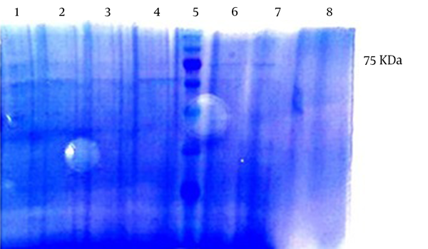 The Puriﬁcation by Ni2+ Chelate Affinity Chromatography Under Denaturant Conditions. Lane 1, 2, 3, and 4, washing steps; Lane 5, the protein marker; Lane 6, 7, and 8, the first, second, and third elute.