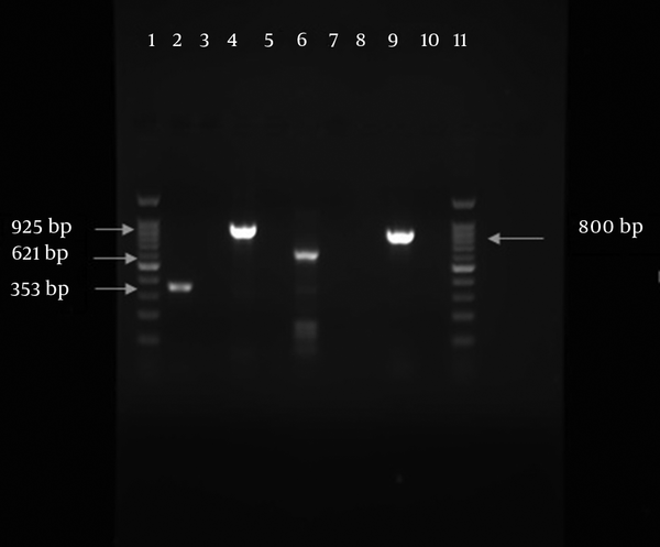 PCR Amplified Products in This Study; Lane 1, DNA ladder 100 bp; lane 2, OXA -51 (353bp); lane 4, bla PER (925 bp); lane 6, control of bla NDM-1 (621 bp); lane 9, bla TEM (800 bp); lane 11, DNA ladder 100 pb.
