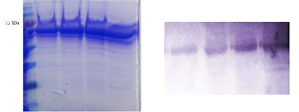 Left, the SDS-PAGE Analysis of Truncated ORF2-NSP4; and Right, the Western Blot Analysis of Truncated ORF2-NSP4 in Sf9 Cells