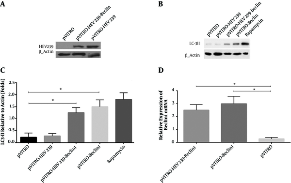 A, HEK293 cells were transfected with HEV239-containing plasmids for 48 hours and cell lysates were detected for HEV239 expression by Western blotting. B, Activation of autophagy was analyzed by the presence of LC3 II in transfected cells. Rapamycin-treated cells were used as a positive control. C, LC3-II levels were quantified relative to β-actin. D, Total RNA was collected from transfected HEK293 cells with pVITRO -Beclin1 or pVITRO-HEV239-Beclin1 and quantitative reverse transcription-PCR was used for examination of Beclin1 mRNA expression. Data are demonstrative as the mean ± standard error of 3 independent experiments (*, ** and *** indicate P &lt; 0.05, P &lt; 0.01 and P &lt; 0.001, respectively).
