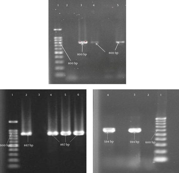 The Frequency of ESBL-Producing Isolates of A. Baumannii Isolated from Clinical Specimens Examined