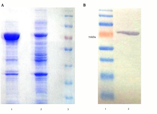 A, SDS-PAGE results of the chimeric protein expression induced by IPTG; expression condition was optimized by using gradient change in temperature, IPTG concentration and growth time.; lane 1, IPTG induced bacteria after 4 hours (concentration, 700 μg/mL), lane 2, negative control cells (non-induced), lane 3, pre-stained protein size marker (70 kDa); B, Western blot; recombinant protein reactivity by western blotting using anti-His Tag antibody; lane 1, protein size marker (70 kDa), lane 2, recombinant protein reactivity by anti-His Tag antibody.
